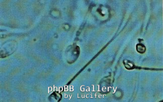 spermatozoaria