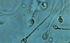 spermatozoaria