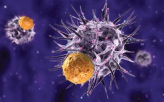melanoma