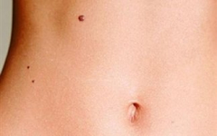 koilia-melanoma